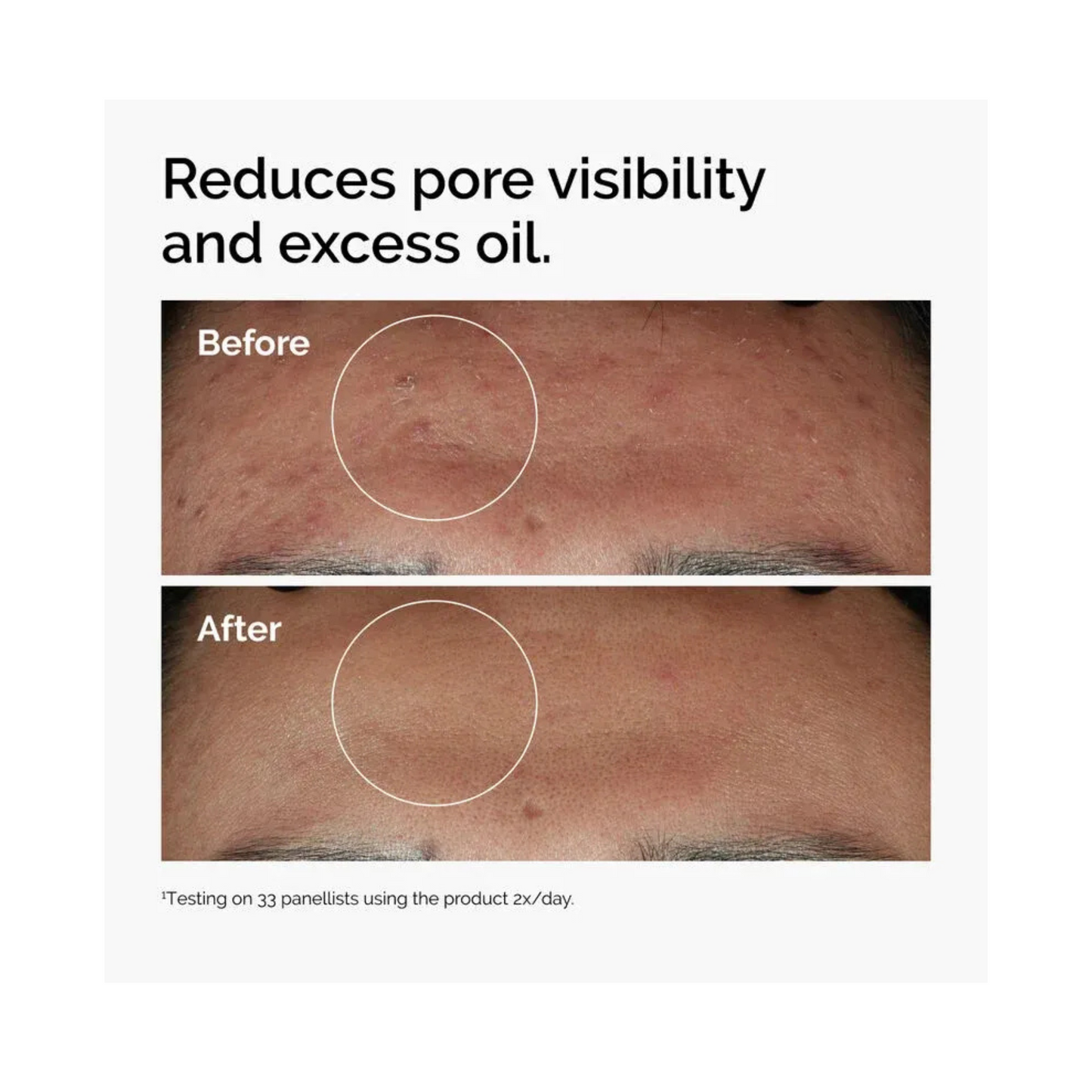 The Ordinary Niacinamide 10%+Zinc1% Serum