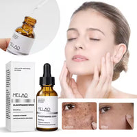 Melao B3 5% Niacinamide Serum
