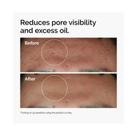 The Ordinary Niacinamide 10%+Zinc1% Serum
